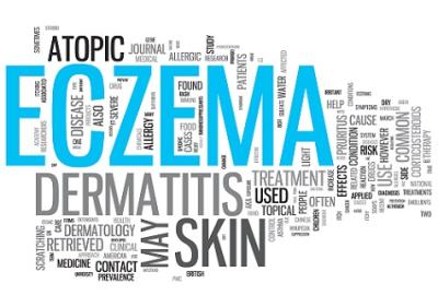 Combat the Effects of Chronic Eczema the Natural Way